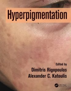 Hyperpigmentation (1)
